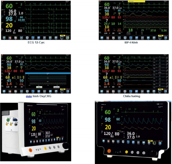 CETUS x15   Màn hình theo dõi bệnh nhân điều trị tích cực